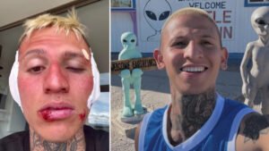 La Liendra reaparece en redes con un preocupante aspecto y revela la insólita razón: "Casi pierdo mis orejitas"